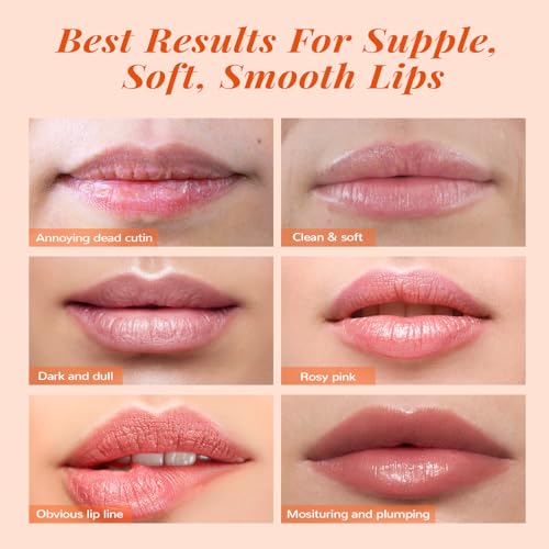 ANAI RUI Lip Scrubber Exfoliator & Lip Balm Hydrating, Lip Exfoliator Scrub and Moisturizer, Lip Sleeping Mask for Dry Dar...