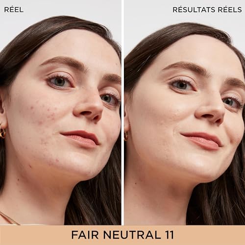 IT Cosmetics Bye Bye Dark Spots Concealer + Brightening Serum – 2% Niacinamide, Hyaluronic Acid & Caffeine - Medium Covera...