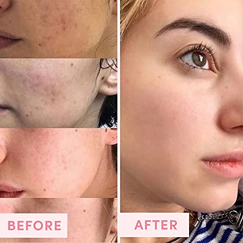 Sand & Sky Clay Mask for Face Pore Minimizer - Australian Pink Clay Detoxifying Face Mask for Pores, Kaolin Clay Mask, Bri...