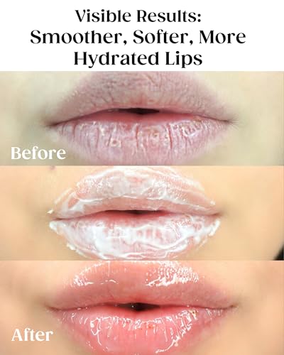 KAPLAN MD Perfect Pout Lip Mask, Volumizing Treatment + Exfoliation, 1.0 oz