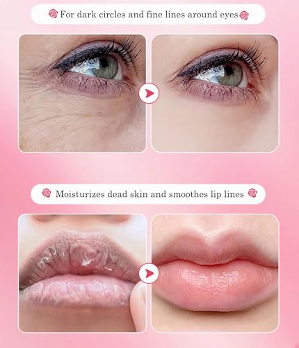 10 Pair Under Eye Mask & 10 Pair Lip Mask Skincare Set, Rose Pink Lip Patches & Under Eye Patches for Puffy Eyes, Dark Cir...