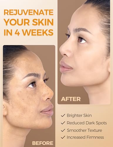 NING DERMOLOGIE Vitamin C Serum with Niacinamide & Ethyl Ascorbic Acid: Brightening, Moisturizing Face Serum for Dark Spot...