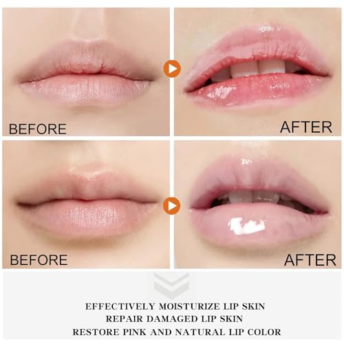 2PCS Natural Plant Lip Balm for Dark Lips,Exfoliating Lip Scrub, Moisturizing Lip Hyaluronic Acid Exfoliating Dead Skin, F...