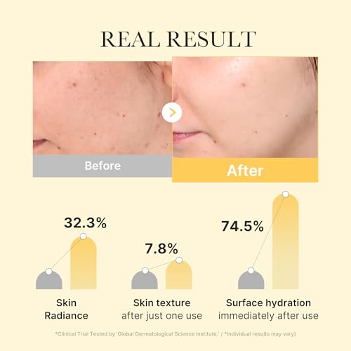 medicube Jelly Gel Mask with Brightening Kojic Acid Turmeric | Overnight Face Mask for Glass Glow Skin | Elasticity, Hydra...