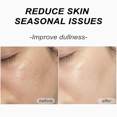 Bukamkom 8pcs Collagen Face Mask, Hydrogel Overnight Face Mask for Hydration & Soothing, Hydrogel Collagen Facial Mask, Fa...