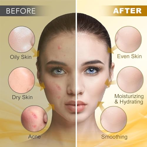 Angeland Jelly Mask for Facials Professional, Hydrating & Moisturizing Peel-Off Natural Gel Face Mask SkinCare, Profession...