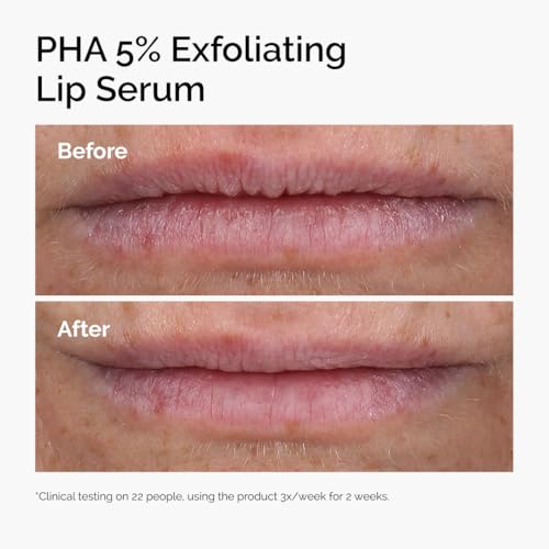 The Ordinary PHA 5% Exfoliating Lip Serum, Hydrating Overnight Lip Exfoliator Treatment, 0.5 Fl Oz