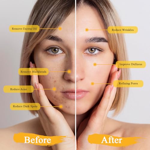 Pjordo 3 Pack clay mask, Turmeric Vitamin C, Avocado, Rose clay mask for face, Face Mask Skin Care for Deep Cleaning Reduc...