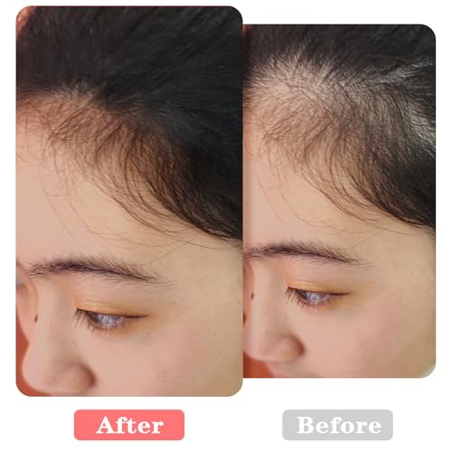 3 Pcs Dual Ended Hairline Brushes, Root Concealer Brush Set with Sponge Tip and Soft Bristles Premium Concealer Brush for ...