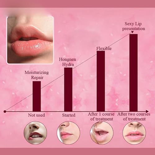 Felico 30PCS Lip Mask, Collagen Crystal Pink Care Gel Pads for Moisturizing,Reducing Chapped,Smoothing,Fine Lines,Remove D...