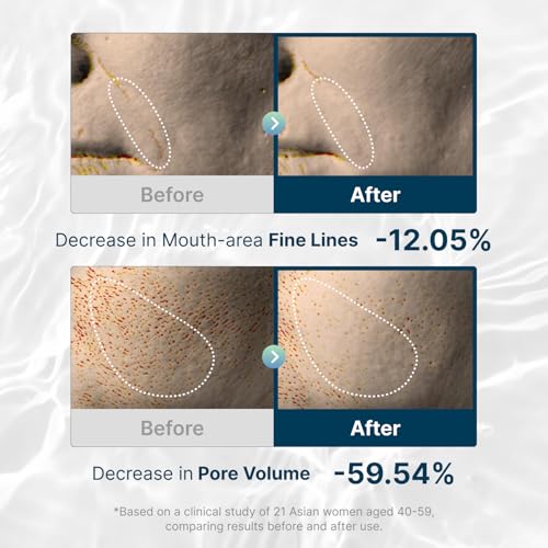 ROOTIO Vegan Collagen Deep Boosting Mask, Hydrating Overnight Face Mask, Pore Minimizing, Elasticity, Firming, Sleeping Hy...