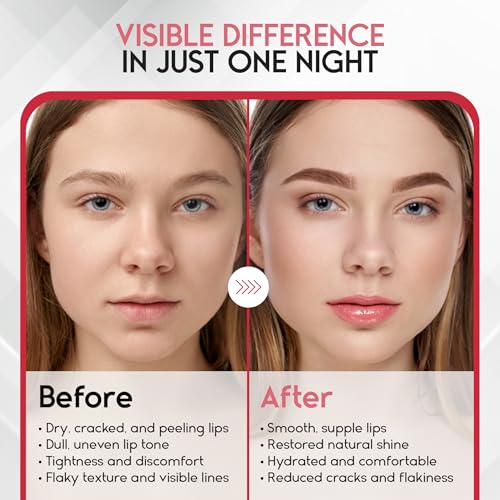 Lip Mask Overnight with Hyaluronic Acid & Collagen, Lip Sleeping Mask for Dry Cracked Lips, Moisturizing, Hydrating, Exfol...