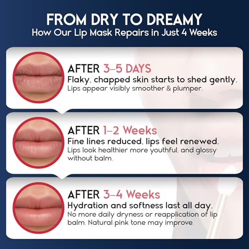 Lip Mask Overnight with Hyaluronic Acid & Collagen, Lip Sleeping Mask for Dry Cracked Lips, Moisturizing, Hydrating, Exfol...