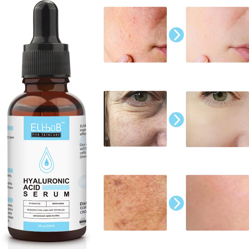 Anti Aging Vitamin C Serum Hyaluronic Acid Serum Set - with Hyaluronic Acid, Skin Care Set Boost Skin Collagen,Hydrate & P...